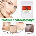 Indian Healing Clay Facial Mask Deep Cleansing Blackhead Remover Brightens Skin Tone Shrink Pores Moisturizing Skin Care. 