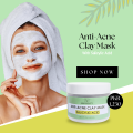 CLAY MASK | ANTI-ACNE CLAY MASK | SALICYLIC ACID | 200G | MASK | FACE MASK | MZ SKINCARE. 