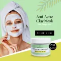 CLAY MASK | ANTI-ACNE CLAY MASK | SALICYLIC ACID | 200G | MASK | FACE MASK | MZ SKINCARE. 