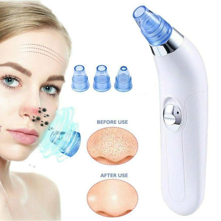 4 in 1 Beauty Facial Dermasuction Pimple Pore Blackhead Remover Vacuum Suction Device Nose Face Deep Cleansing Skin Care Facial Cleaner Tools Device Pores Acne Skin For Men And Women
