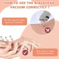 Dynamic Life 5 in 1 Rechargable Derma Suction Blackhead Removal Machine Vacuum Suction Cystic Acne Scars Pimple Pore Pooping Oil Cleaner Face Facial Beauty Tool Whitehead Extractor Device Kit Skin Body with 3 Modes,. 