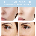 UPTOWN LA  Pore-Refining Treatment Gel (Niacinamide + Witch-hazel)  - 50g. 