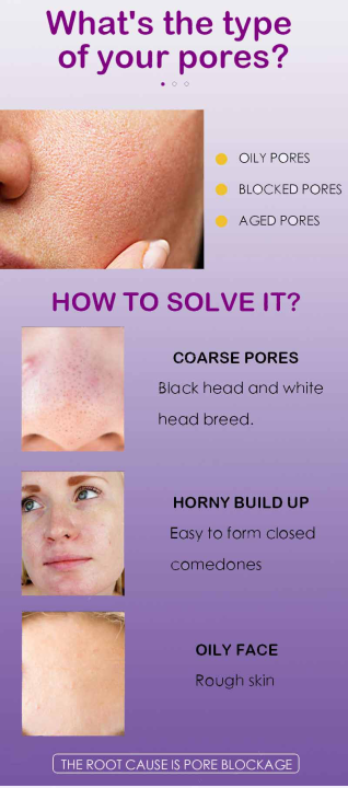 UPTOWN%20LA%20PORE%20REFINING%20Serum%20with%20lactobionic%20acid%20and%20Niacinamide%20For%20shrinking%20pores%20For%20all%20skin%20types%2030%20ML%20-%20Image%205