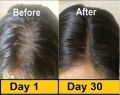 Evion Vitamin E 50  Capsules Skin Care Products  Nourishing and Strengthening Hair Supports Healthy Growth Reduces Hair Loss Enhances Shine Suitable for All Hair Types Essential Nutrient for Damaged Hair Premium Quality Supplement for Women and Men. 