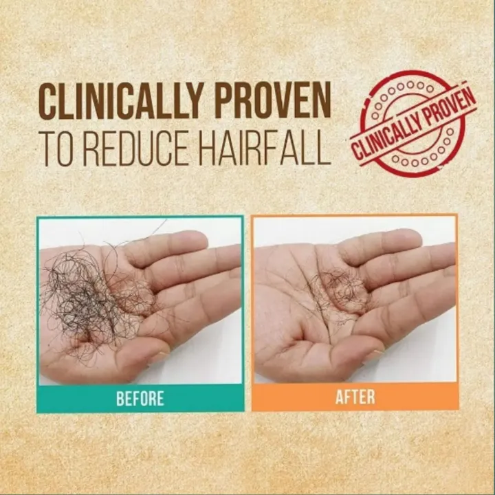 Hair%20Oil%20Bottle%20With%20Comb%20%7C%20Best%20For%20Dandruff%20&%20Hair%20Fall%20%7C%20Anti%20Lice%20Comb%20%7C%20Imported%20Multipurpose%20Applicator%20-%20Image%208