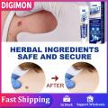 20g Instant Blemish Removal Gel Wart Removal Body Warts Treatment Cream Foot Care Cream Skin Tag Remover Wart Cream. 