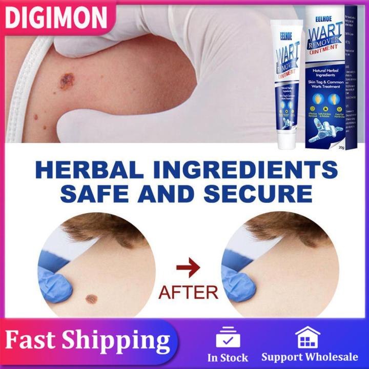 20g Instant Blemish Removal Gel Wart Removal Body Warts Treatment Cream Foot Care Cream Skin Tag Remover Wart Cream