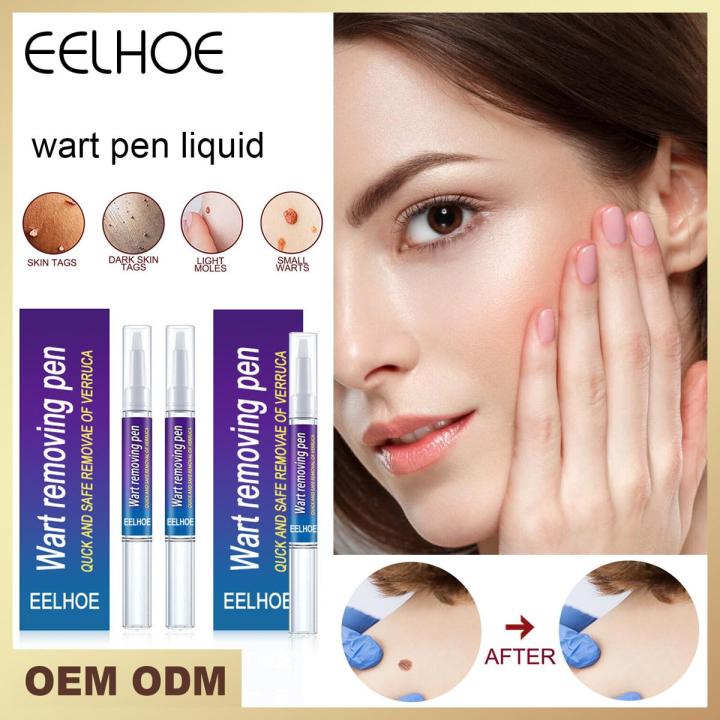 EELHOE Skin Tag Remover Eliminate Warts Remover Cream Body Mole Wart Remover Corn Plaster Filiform Flat Warts 5ml Free Shipping