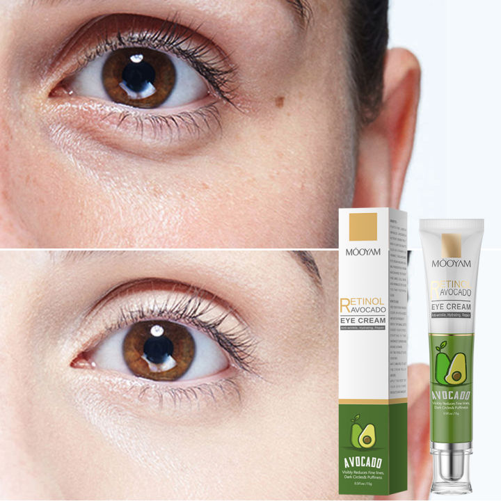 Retinol Eye Cream Dark Circles Remover Anti-Wrinkle Firmness Whitening Under Eyes Serum Skin Care Beauty 15g Feeoi Freeio