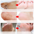 Efero Lavender Foot Peeling Mask Exfoliating Pedicure Feet Mask Remove Dead Skin Heels Moisturizng Feet Care. 