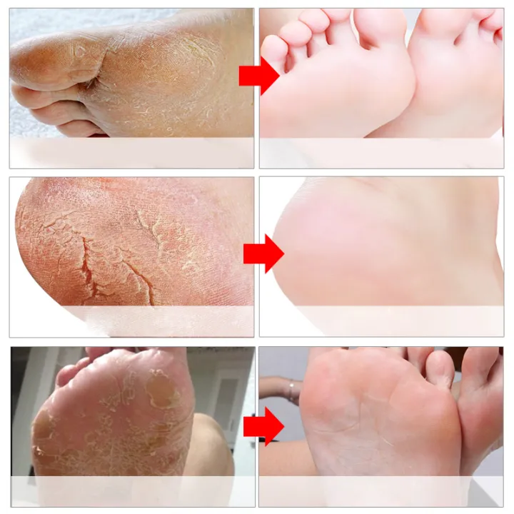 Efero%20Lavender%20Foot%20Peeling%20Mask%20Exfoliating%20Pedicure%20Feet%20Mask%20Remove%20Dead%20Skin%20Heels%20Moisturizng%20Feet%20Care%20-%20Image%208