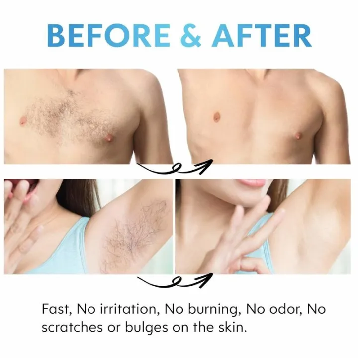 Hair%20Eraser%20Pain%20Less%20for%20Women%20and%20Men%20%7C%20Washable%20Portable%20Crystal%20Hair%20Body%20Removal%20Device%20Beauty%20Tool%20Hair%20Eraser%20%7C%20Hair%20Removal%20Painless%20Physical%20Manual%20Epilator%20%7C%20SJR%20Collections%20-%20Image%208