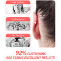 2/4/6/8Pcs Portable Small Invisible Protruding Ears Correctar Tape Ear Aesthetic Correctar Without Surgery Beauty Makeup Tool. 