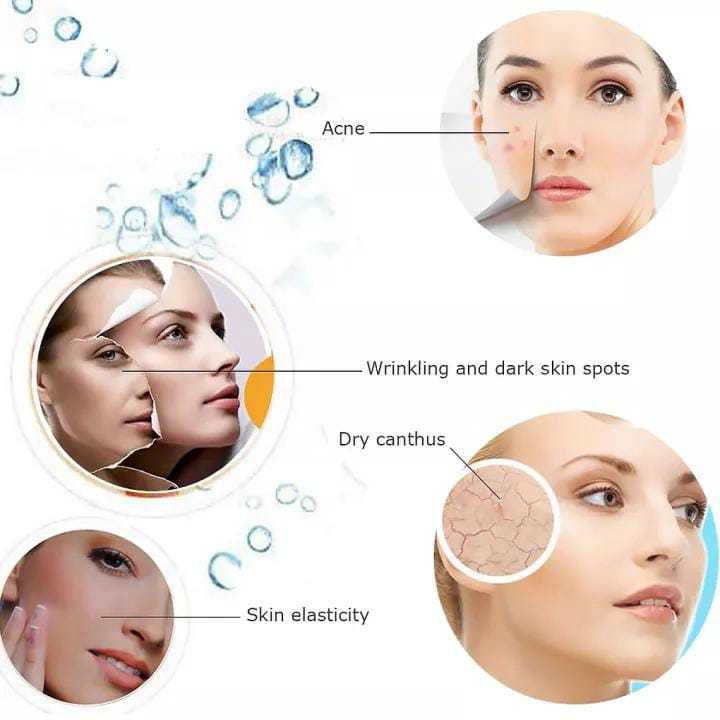SHINON%20%E2%80%93%20The%20Steam%20Facial,%20Steamer%20&%20Steam%20Inhaler%20-%20Image%207