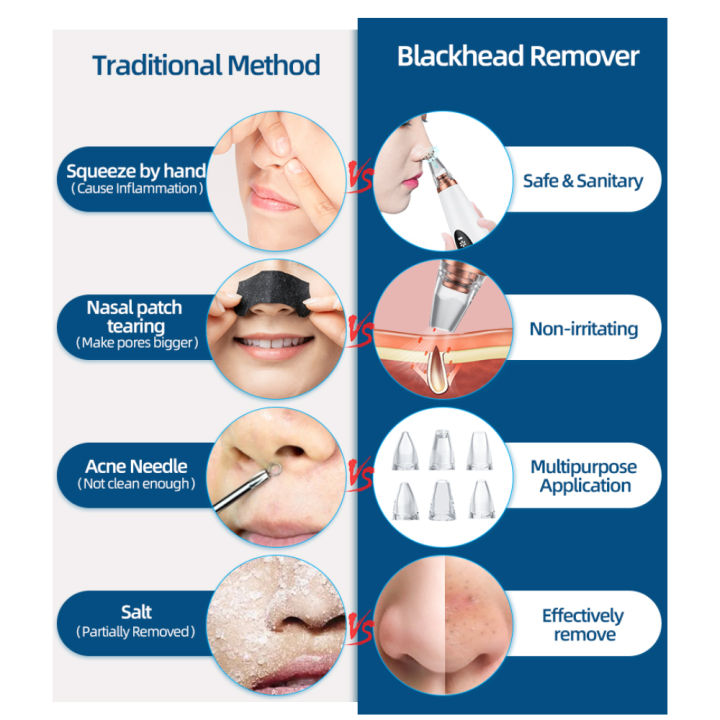 Multi-Functional%20Rechargeable%206%20Suction%20Heads%20Blackhead%20Whitehead%20Extractor%20Remover%20Device%20Suction%20Tool%20-%20Image%207
