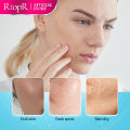 RtopR Vitamin C Serum Snail Brightening Fade Dark Spot Lightening Serum Brightening Skin Care Fine Lines Anti-aging Whiten Moisturize Less Breakouts Facial Serum Skincare for Men and Women 20ml. 