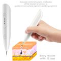 Tattoos Mole Remover Laser Plasma Pen Plasma Jet Caneta Jato De Plasma Verrugas Eliminar Papilloma Black Spots Remover Beauty. 