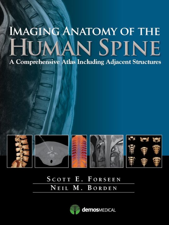 Imaging Anatomy of the Human Spine A Comprehensive Atlas Including Adjacent Structures