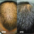 Homeo Hair Serum. 