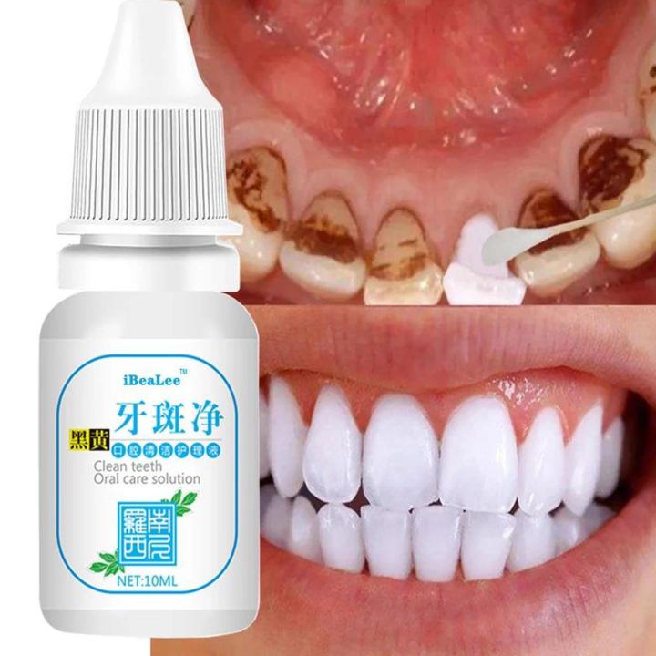Teeth%20Cleaning%20Esence%20Naturally%20brighting%20Liquid%20%7C%20Teeth%20Whitening%20Powder%20Clean%20Oral%20Hygiene%20Whiten%20Teeth%20Remove%20Plaque%20Stains%20Fresh%20Breath%20Oral%20Hygiene%20Dental%20Tools%20-%20Image%202