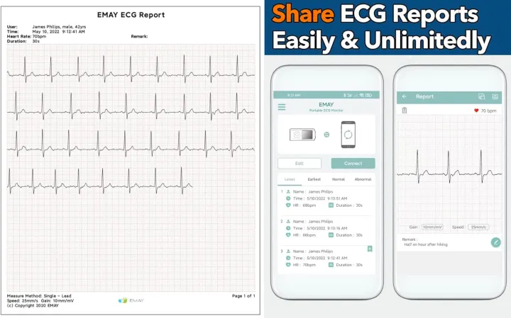 EMAY%20Portable%20ECG%20Monitor%20%7C%20Record%20ECG%20and%20Heart%20Rate%20%7C%20Compatible%20with%20Smartphone%20and%20PC%20-%20Image%203