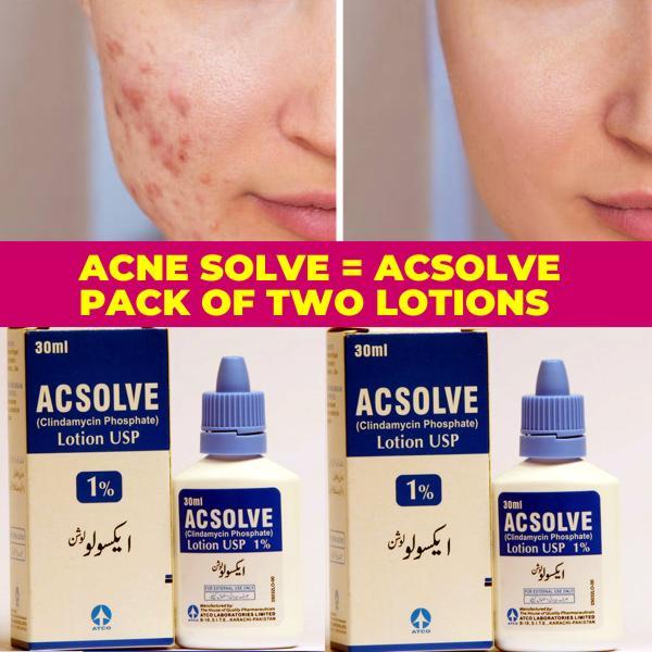 AcSolve Acne Gel Pack of 2 Fast-Acting, Dermatologist-Approved Clindamycin Phosphate 1% Gel for Clearer Skin!