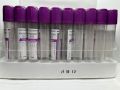10ml EDTA Blood Collection Tube: Clinical Quality Assurance. 