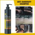UPTOWN LA ANTI DANDRUFF SHAMPOO FOR CONTROLLING DANDUFF DRYNESS AND ITCHINESS WITH SELENIUM SULFIDE AND ZINC PYRITHIONE  200 ML. 