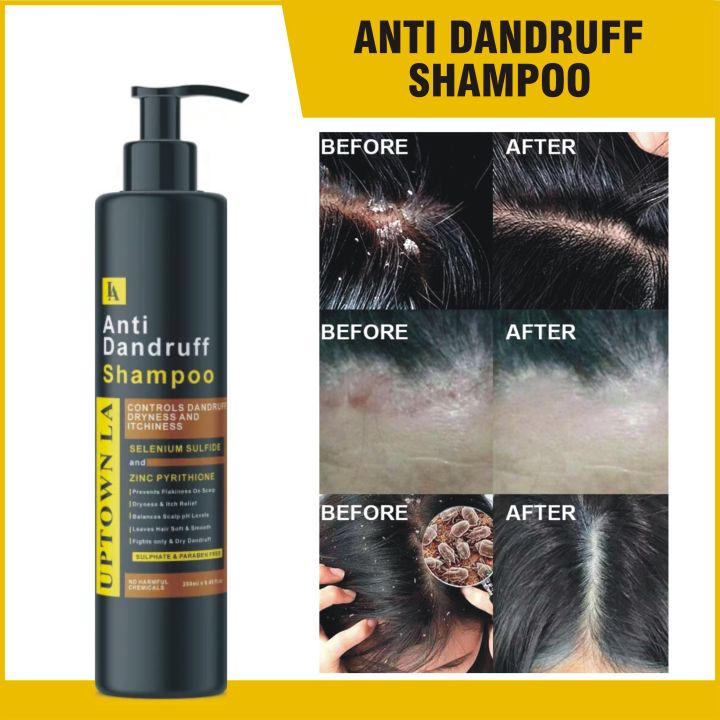 UPTOWN LA ANTI DANDRUFF SHAMPOO FOR CONTROLLING DANDUFF DRYNESS AND ITCHINESS WITH SELENIUM SULFIDE AND ZINC PYRITHIONE  200 ML