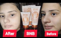 BNB Rice Facial Kit Organic – Complete BNB Kit with BNB Scrub, BNB Mask & BNB Facewash – BNB Rice Kit – Original BNB Products. 