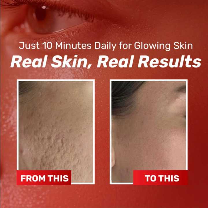 Chalonese%20Brightening%20Cream%2020g%20for%20Acne%20Marks%20&%20Pigmentation%20%7C%20Daily%20Face%20Cream%20for%20Uneven%20Skin%20Tone,%20Dark%20Patches%20&%20Dullness%20%7C%20Gentle%20Formula%20for%20Smooth,%20Clear%20&%20Radiant%20Skin%20-%20Image%205