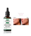 Arfa Cosmetics Salicylic Acid Anti Acne Serum with Salicylic Acid Oil Control and Acne Removal Acne Skin Care Products All Skin Types Use 30Ml. 