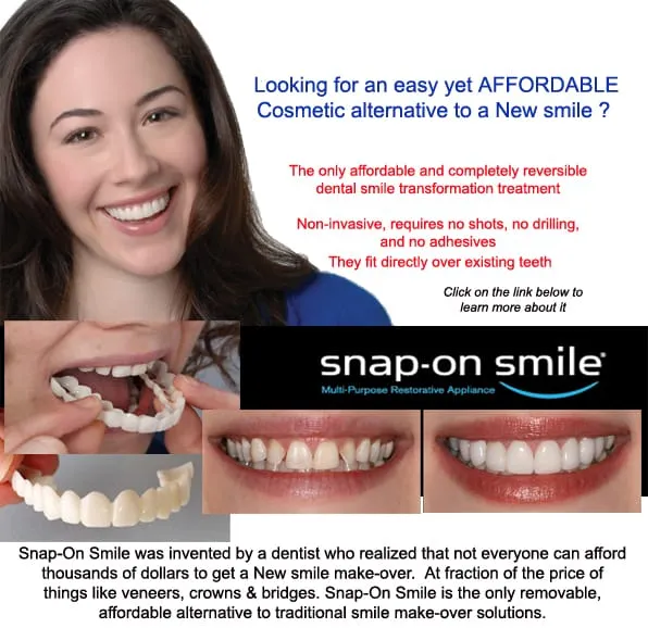 Perfect%20Fit%20Snap-On%20Smile%20Veneers%20%E2%80%93%20Upper%20&%20Lower%20Natural%20Look%20Teeth%20Covers%20&%20Braces%20-%20Image%202