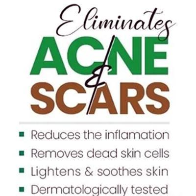 AcSolve%20Acne%20Gel%20Fast-Acting,%20Dermatologist-Approved%20Clindamycin%20Phosphate%201%25%20Gel%20for%20Clearer%20Skin!%20-%20Image%202
