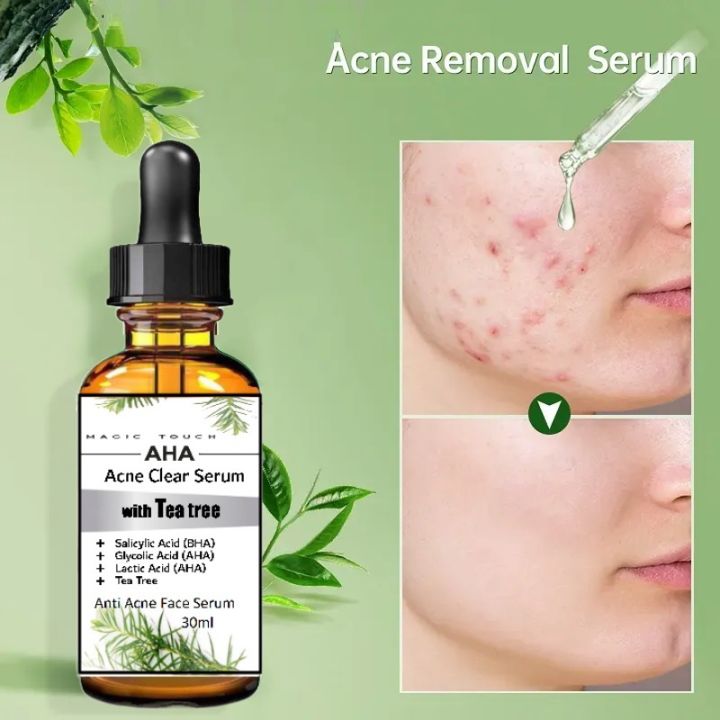 Magic Touch Anti Acne serum with Salicylic Acid for oil Control and acne removal 30 ml with Tea tree oil and Glycolic Acid (AHA)
