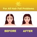 SILKO Gold Biotin + Keratin Shampoo (200ml) - Anti Hair Loss Shampoo - Reduce Hair Fall &. 