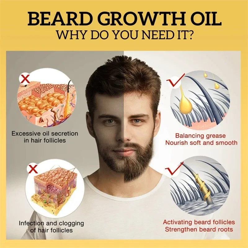 UPTOWN LA Beard Growth Oil for Men | Beard Growth Guaranteed with Argan & Geranium For faster Growth | For Beard Growth | Softness| Shine | Patchy Beard | 30 ML | Daraz.pk