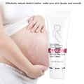 Stretch Marks Scar Removal Maternity Skin Body Repair Cream. 