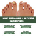 South Moon Toenail Repair Kit Cleansing Nail Nail Nail Thickening Hand & Foot Thickening Nail Repair Kit. 