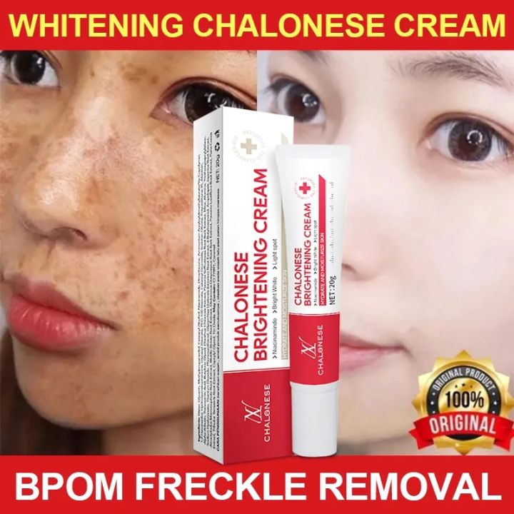 Chalonese Brightening Cream Skin Valor Whitening Cream 50g | Brightening & Whitening Face Cream | Dark Spot Remover & Hyperpigmentation Solution | Radiant Glow Daily Moisturizer | Safe & Effective Skincare for Men & Women | Suitable for All Skin Types