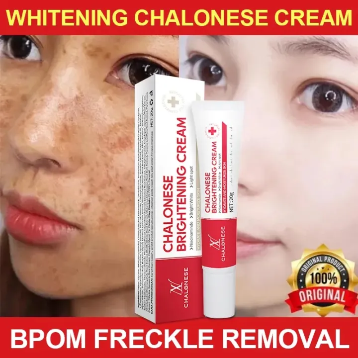CHALONESE%20Brightening%20Cream%20Serum%20%E2%80%93%2020g%20%7C%20Anti-Freckle,%20Dark%20Spot%20Removal%20&%20Skin%20Tone%20Correction%20%7C%20Herbal%20&%20Gentle%20Formula%20-%20Image%202