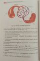 BD Chaurasia Handbook of General Anatomy  9th Edition by Krishna Garg. 