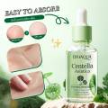 Bioaqua Centella Asiatica Soothing Repair Anti Acne Face Serum Essence 30ml. 
