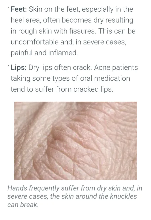 Eucerin%20Baby%20Eczema%20Relief%20Cream%20clinically%20proven%20to%20reduce%20incidence%20of%20eczema%20flare-ups%20Imported%20from%20U.S.A%20144g%20-%20Image%202