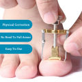 Professional Ingrown Toe Nail Correction Pedicure Toes Treatment Tool for Paronychia, Ingrown Nail Corrector Toenail Foot Nail Care,Eliminate Pain & Remover Orthotic Appliance, Stainless Steel Toes Treatment Manicure Pedicure Tool. 