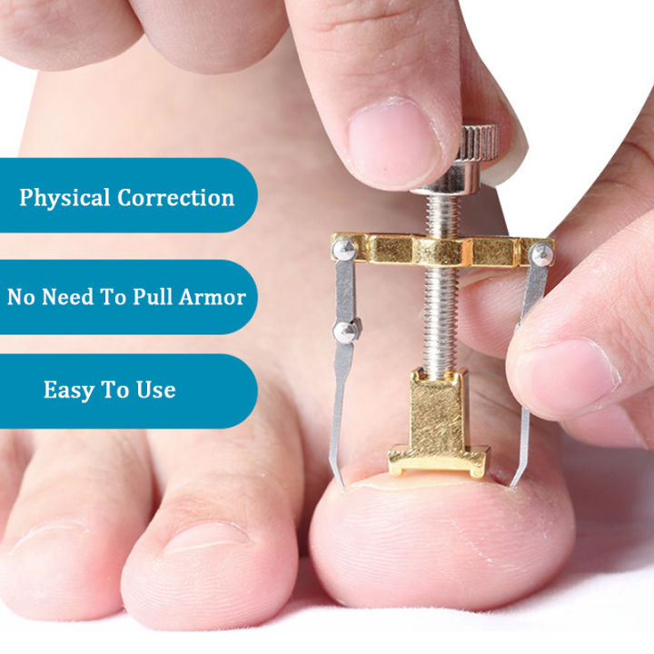 Professional%20Ingrown%20Toe%20Nail%20Correction%20Pedicure%20Toes%20Treatment%20Tool%20for%20Paronychia,%20Ingrown%20Nail%20Corrector%20Toenail%20Foot%20Nail%20Care,Eliminate%20Pain%20&%20Remover%20Orthotic%20Appliance,%20Stainless%20Steel%20Toes%20Treatment%20Manicure%20Pedicure%20Tool%20-%20Image%207