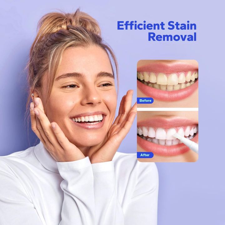 Dazzling White Teeth Whitening Pen Easy To Use Instant Tooth Bleaching Whiter Dental Lab Gel Cleaning Remove Stain Oral Hygiene