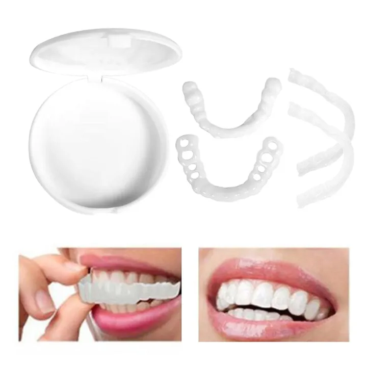 Perfect%20Fit%20Snap-On%20Smile%20Veneers%20%E2%80%93%20Upper%20&%20Lower%20Natural%20Look%20Teeth%20Covers%20&%20Braces%20-%20Image%205
