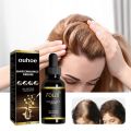 30Ml Hair Growth Essential Oil Pure Natural Nourish Repair Damaged Dry and Frizz Hair Rosemary Anti Hair Loss Serum Oil. 