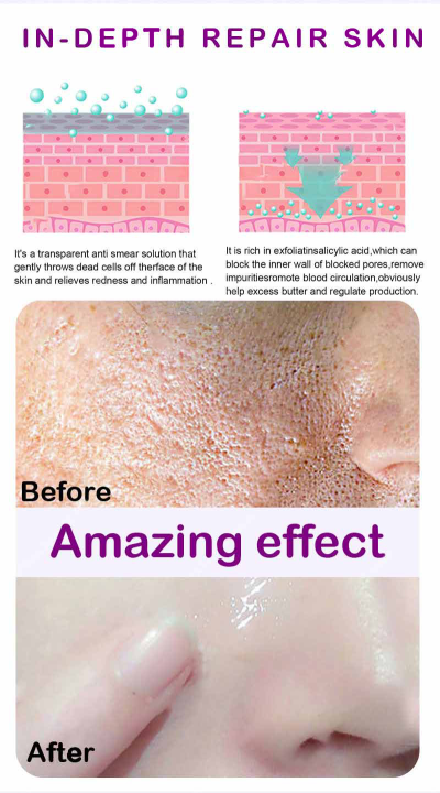 UPTOWN%20LA%20PORE%20REFINING%20Serum%20with%20lactobionic%20acid%20and%20Niacinamide%20For%20shrinking%20pores%20For%20all%20skin%20types%2030%20ML%20-%20Image%207